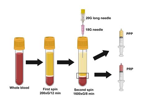 plasma centrifuge|plasma isolation from blood protocol.